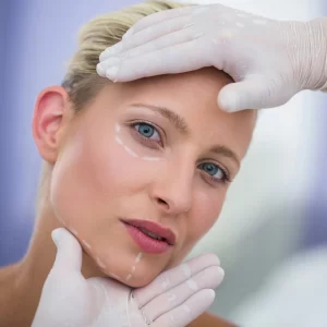 lifting-facial-fire-resorbabile