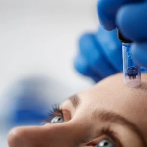 microneedling-dermapen