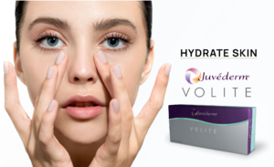 Juvederm-Volite