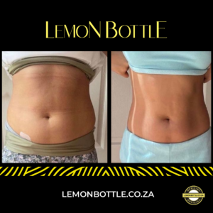 Pacientă în timpul tratamentului cu Lemon Bottle pentru bărbie dublă la Top Skin Bucuresti