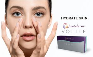 Juvederm-Volite-Filler