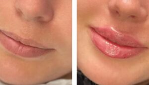 Russian-Lip