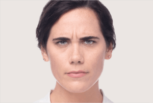 dysport Tratament complet facial inainte