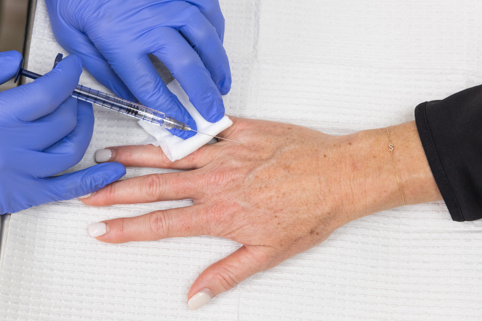 Procedură injectabilă pentru mâini