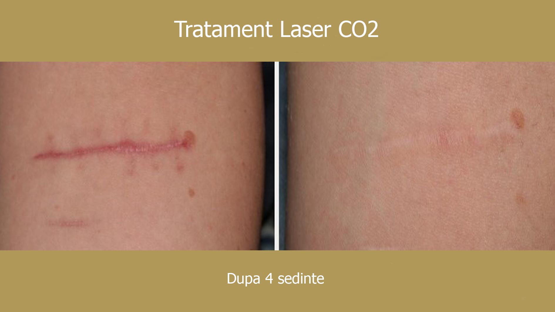 Textura pielii în zona cicatricilor