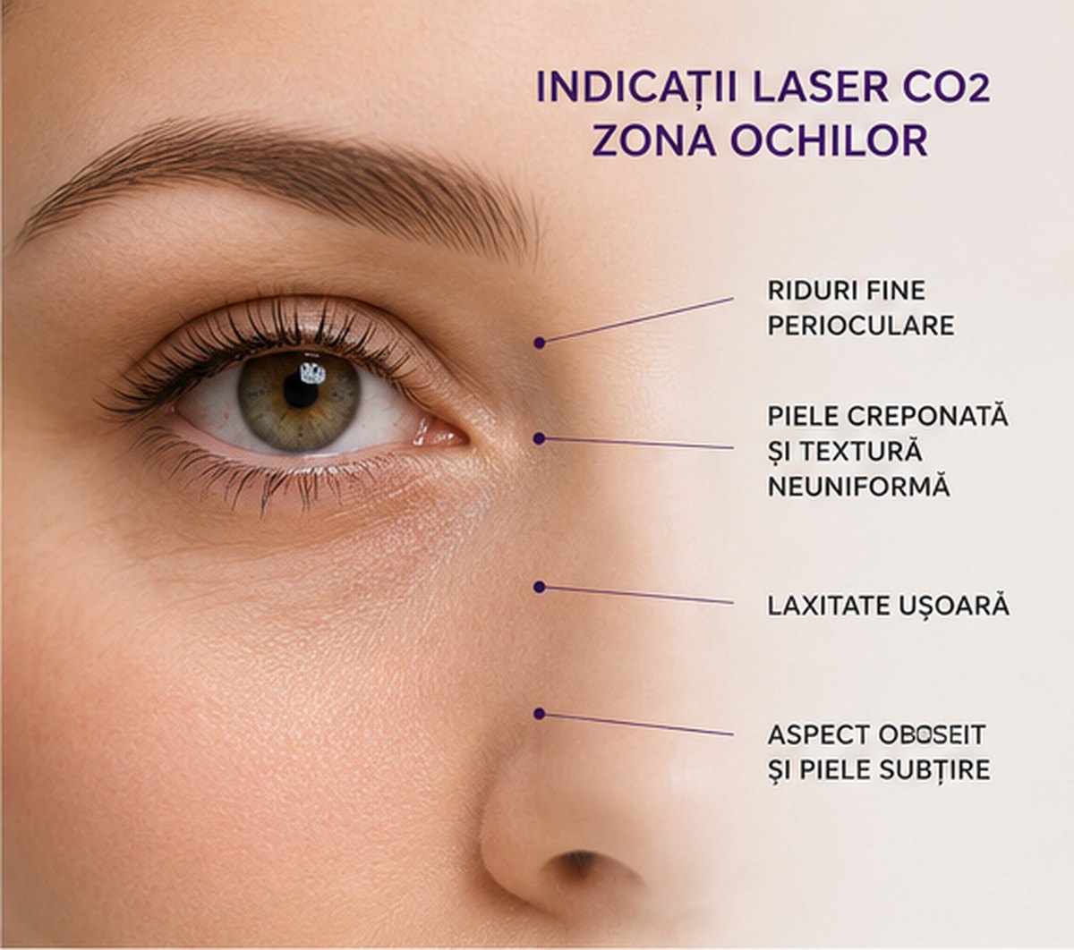 Indicatii Laser CO2 zona ochilor pentru riduri fine piele creponata laxitate usoara si textura
