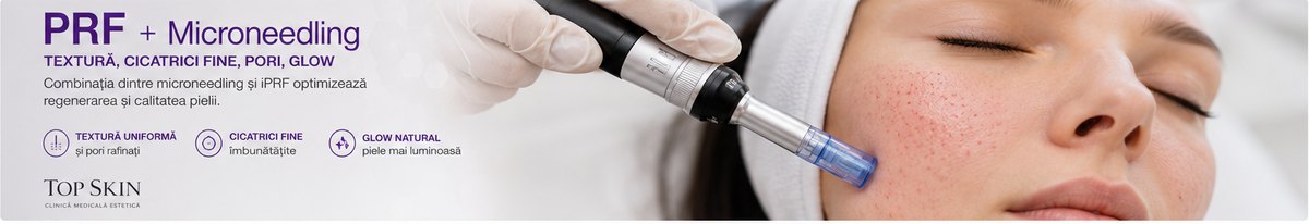 PRF combinat cu microneedling pentru regenerarea pielii la Top Skin Bucuresti