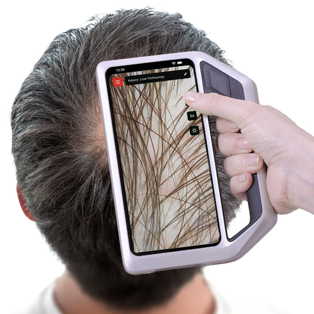 FotoFinder skeen pentru dermatoscopie digitală, fotomonitorizarea leziunilor și tricoscopie la Top Skin București