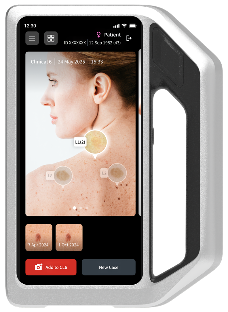 FotoFinder skeen, dermatoscop digital utilizat la Top Skin pentru evaluarea alunițelor și petelor maronii