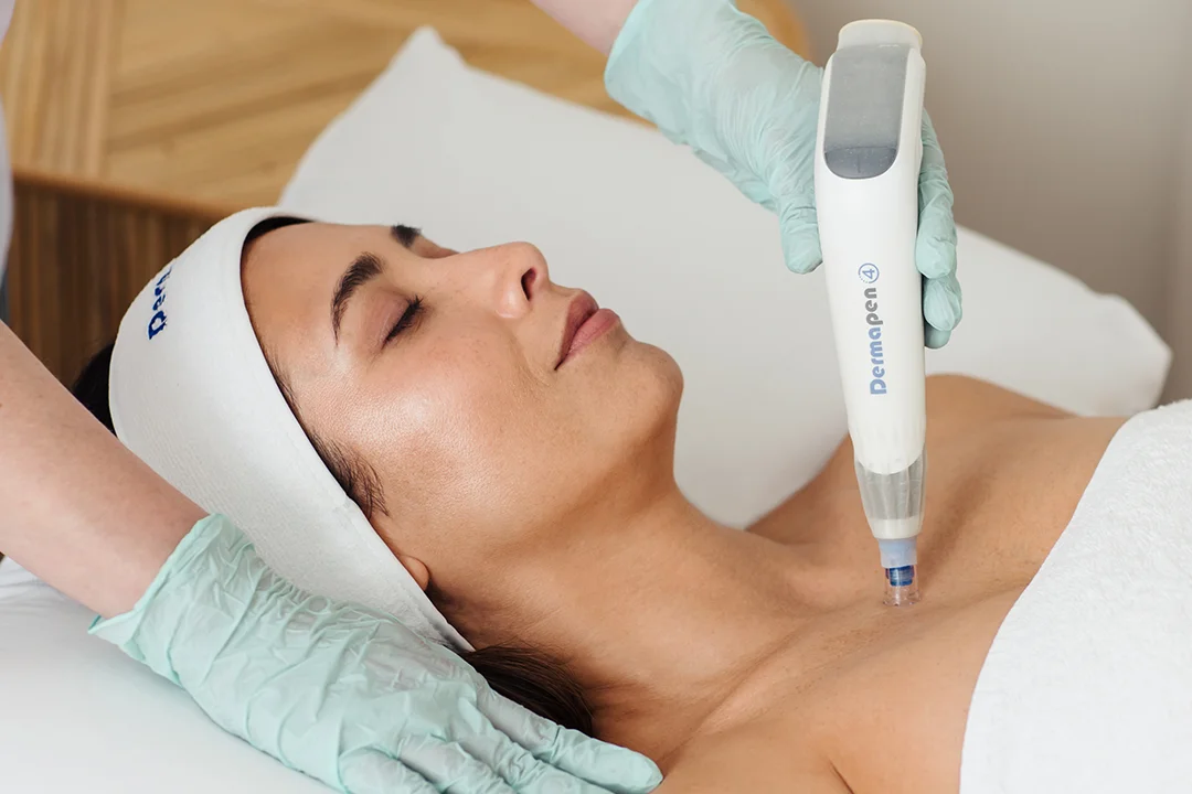 Procedură de microneedling cu aparatul Dermapen 4 original