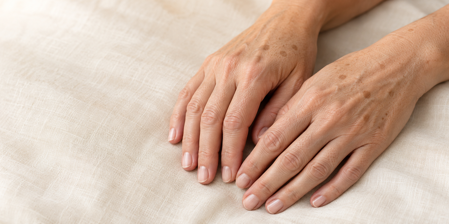 Pete maronii pe mâinile unei femei mature – evaluare dermatologică Top Skin București